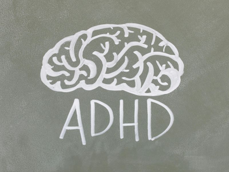 En tegning af en hjerne med hvid tusch med skriften ADHD nedenunder 